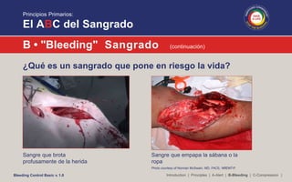 Bleeding control basic presentation | PPTX