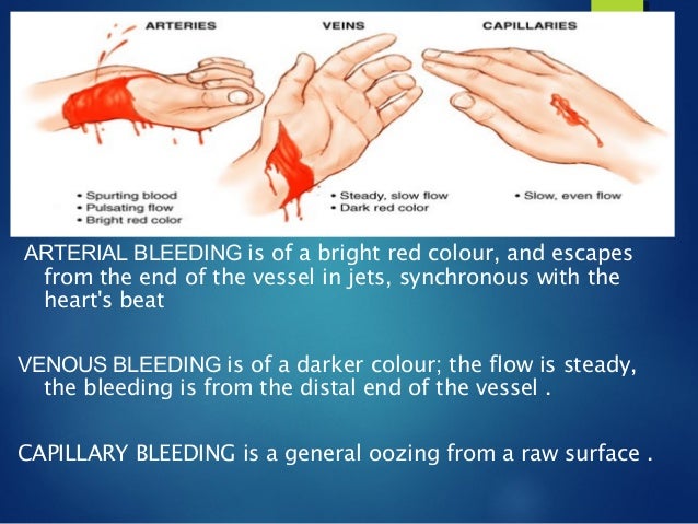 Bleeding control mit - How Long Does It Take To Bleed Out