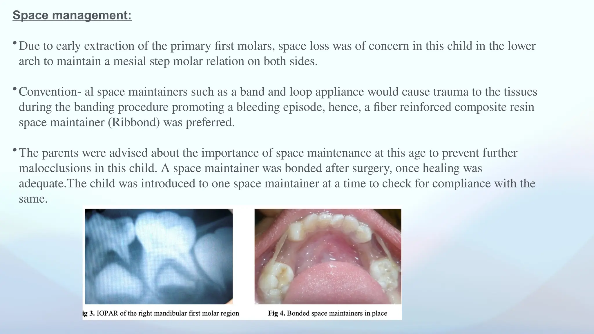 Space management:
•Due to early extraction of the primary first molars, space loss was of concern in this child in the lower
arch to maintain a mesial step molar relation on both sides.
•Convention- al space maintainers such as a band and loop appliance would cause trauma to the tissues
during the banding procedure promoting a bleeding episode, hence, a fiber reinforced composite resin
space maintainer (Ribbond) was preferred.
•The parents were advised about the importance of space maintenance at this age to prevent further
malocclusions in this child. A space maintainer was bonded after surgery, once healing was
adequate.The child was introduced to one space maintainer at a time to check for compliance with the
same.
 