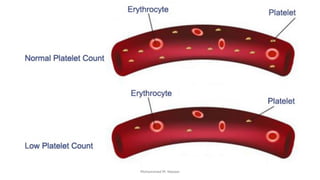 Dyscariasis Bleeding Disorder & Blood dyscrasias MMN.pdf