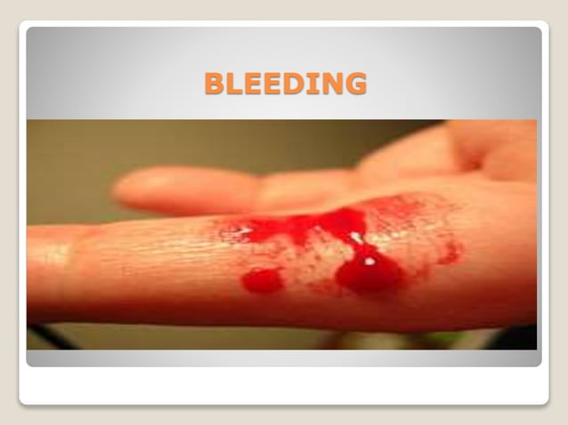 Bleeding disorders | PPT