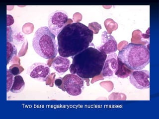 Two bare megakaryocyte nuclear masses
 
