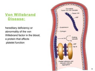 Von Willebrand
Disease:
hereditary deficiency or
abnormality of the von
Willebrand factor in the blood,
a protein that affects
platelet function
39
 