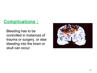 Complications :
Bleeding has to be
controlled in instances of
trauma or surgery, or else
bleeding into the brain or
skull can occur.
53
 