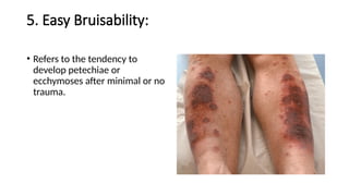Bleeding Disorders for mbbs mlt mls nursing operation theater ...