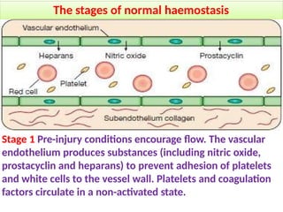 Bleeding disorders (hemostatic disorders).pptx
