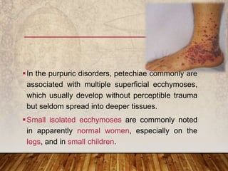 In the purpuric disorders, petechiae commonly are
associated with multiple superficial ecchymoses,
which usually develop without perceptible trauma
but seldom spread into deeper tissues.
Small isolated ecchymoses are commonly noted
in apparently normal women, especially on the
legs, and in small children.
 