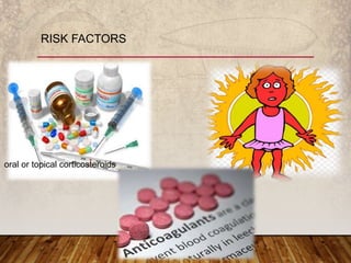 RISK FACTORS
oral or topical corticosteroids
 