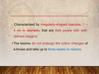  Characterised by irregularly-shaped macules, 1 –
4 cm in diameter, that are dark purple with well-
defined margins.
The lesions do not undergo the colour changes of
a bruise and take up to three weeks to resolve.
 