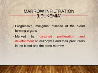 • Progressive, malignant disease of the blood
forming organs
• Marked by distorted proliferation and
development of leukocytes and their precursors
in the blood and the bone marrow
MARROW INFILTRATION
(LEUKEMIA)
 