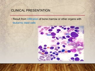 • Result from infiltration of bone marrow or other organs with
leukemic blast cells
CLINICAL PRESENTATION
 
