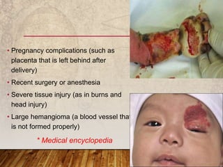 • Pregnancy complications (such as
placenta that is left behind after
delivery)
• Recent surgery or anesthesia
• Severe tissue injury (as in burns and
head injury)
• Large hemangioma (a blood vessel that
is not formed properly)
* Medical encyclopedia
 