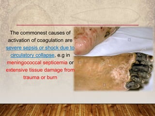 The commonest causes of
activation of coagulation are
severe sepsis or shock due to
circulatory collapse, e.g in
meningococcal septicemia or
extensive tissue damage from
trauma or burn
 