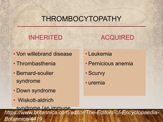 INHERITED
• Von willebrand disease
• Thrombasthenia
• Bernard-soulier
syndrome
• Down syndrome
• Wiskott-aldrich
syndrome (an immune
disorder).
ACQUIRED
• Leukemia
• Pernicious anemia
• Scurvy
• uremia
THROMBOCYTOPATHY
https://www.britannica.com/editor/The-Editors-of-Encyclopaedia-
Britannica/4419
 