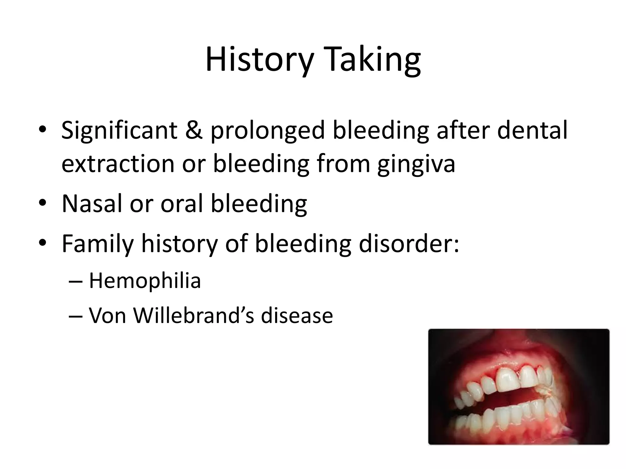 Bleeding Disorders in Primary Dental Care | PDF