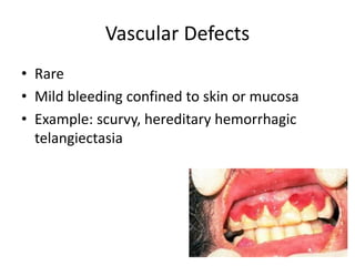 Bleeding Disorders in Primary Dental Care | PDF