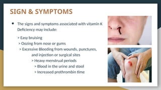 Bleeding disorders pathology presentation .pptx