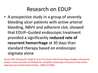 Research on EDUP
• A prospective study in a group of severely
bleeding ulcer patients with active arterial
bleeding, NBVV and adherent clot, showed
that EDUP–Guided endoscopic treatment
provided a significantly reduced rate of
recurrent hemorrhage at 30 days than
standard therapy based on endoscopic
stigmata alone
Jensen DM, Ohning GV, Singh B, et al. For severe UGI hemorrhage Doppler ultrasound
probe is more accurate and helpful for complete endoscopic hemostasis than lesion
stigmata alone Gastrointest Endosc. 2008; 67:AB81.
 