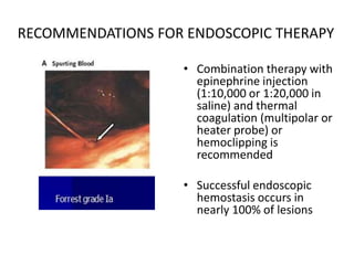 RECOMMENDATIONS FOR ENDOSCOPIC THERAPY
• Combination therapy with
epinephrine injection
(1:10,000 or 1:20,000 in
saline) and thermal
coagulation (multipolar or
heater probe) or
hemoclipping is
recommended
• Successful endoscopic
hemostasis occurs in
nearly 100% of lesions
 