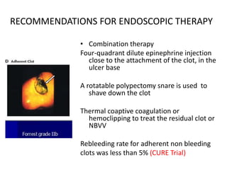RECOMMENDATIONS FOR ENDOSCOPIC THERAPY
• Combination therapy
Four-quadrant dilute epinephrine injection
close to the attachment of the clot, in the
ulcer base
A rotatable polypectomy snare is used to
shave down the clot
Thermal coaptive coagulation or
hemoclipping to treat the residual clot or
NBVV
Rebleeding rate for adherent non bleeding
clots was less than 5% (CURE Trial)
 