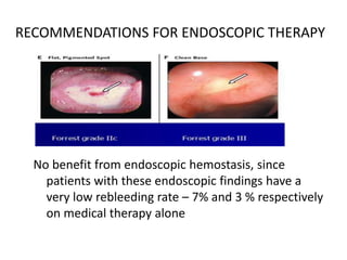 RECOMMENDATIONS FOR ENDOSCOPIC THERAPY
No benefit from endoscopic hemostasis, since
patients with these endoscopic findings have a
very low rebleeding rate – 7% and 3 % respectively
on medical therapy alone
 