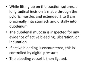 • While lifting up on the traction sutures, a
longitudinal incision is made through the
pyloric muscles and extended 2 to 3 cm
proximally into stomach and distally into
duodenum
• The duodenal mucosa is inspected for any
evidence of active bleeding, ulceration, or
induration
• If active bleeding is encountered, this is
controlled by digital pressure
• The bleeding vessel is then ligated.
 