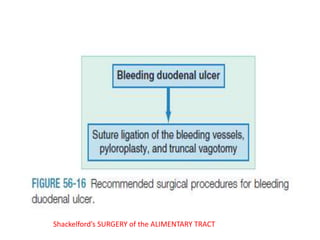 Shackelford’s SURGERY of the ALIMENTARY TRACT
 