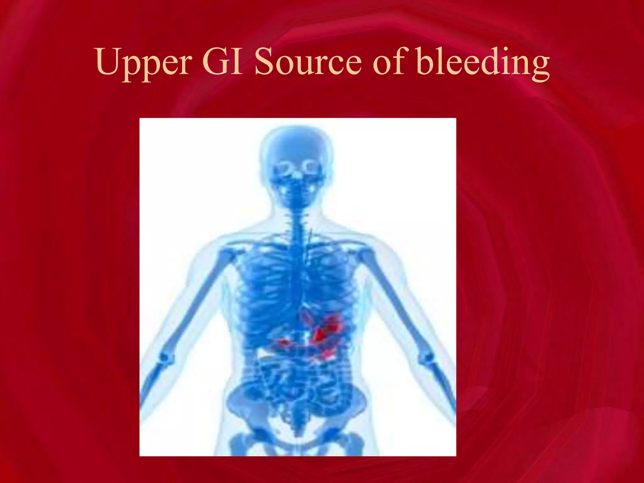 Upper GI Source of bleeding
 