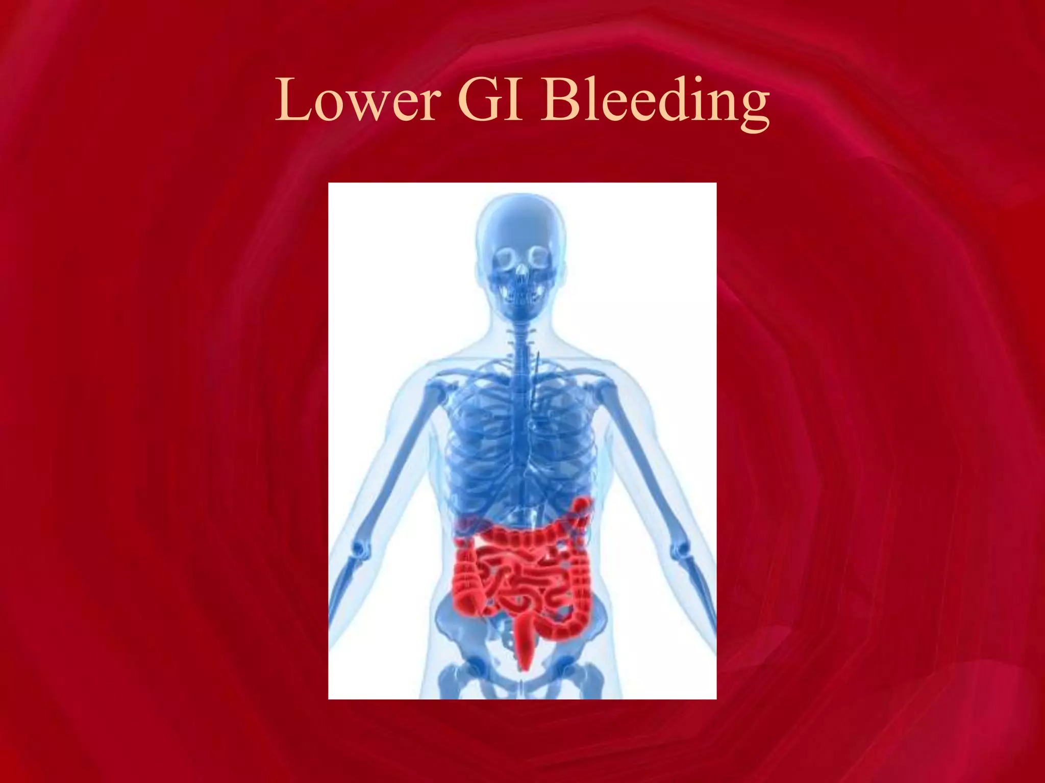 Lower GI Bleeding
 