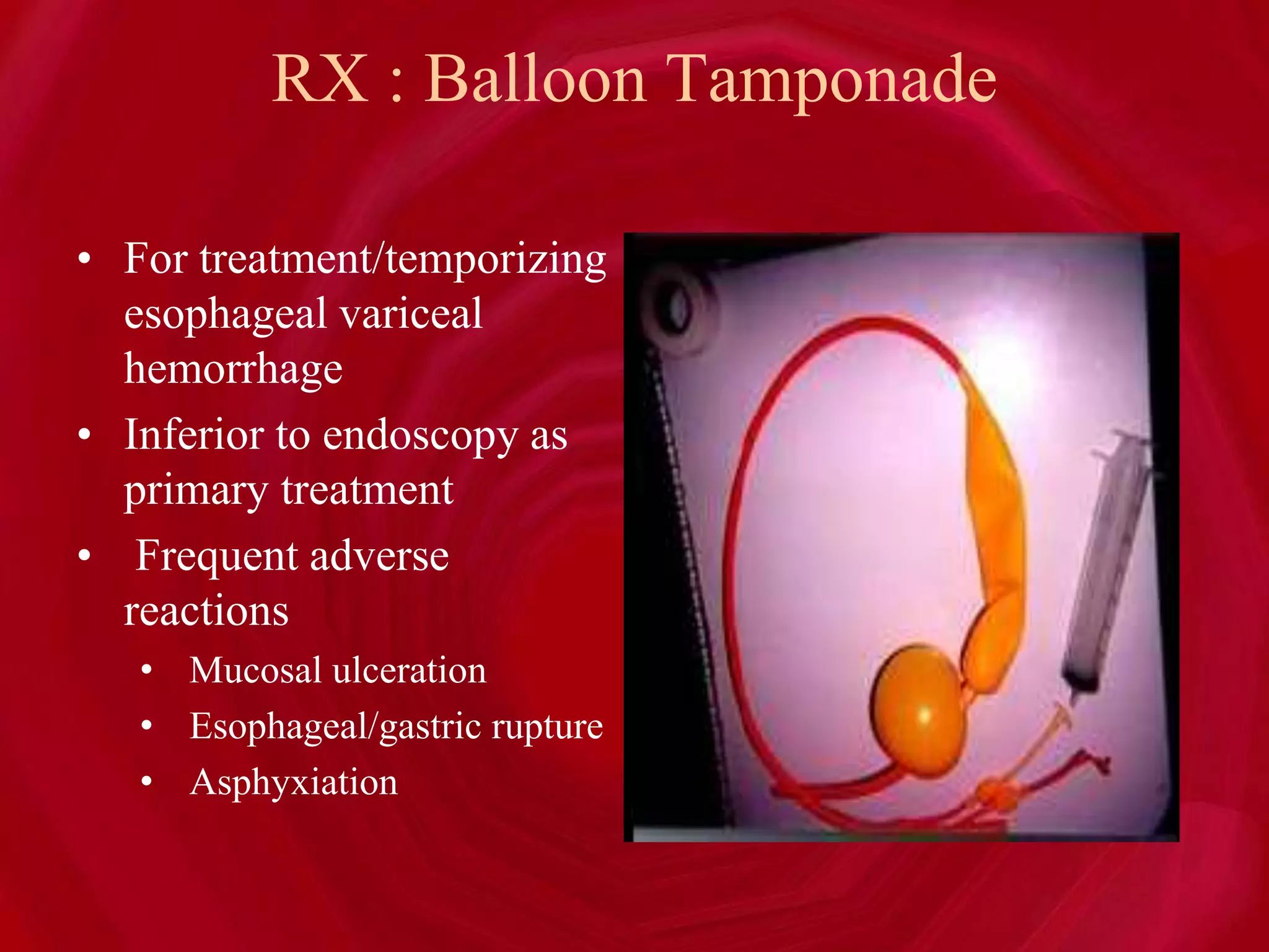 RX : Balloon Tamponade
• For treatment/temporizing
esophageal variceal
hemorrhage
• Inferior to endoscopy as
primary treatment
• Frequent adverse
reactions
• Mucosal ulceration
• Esophageal/gastric rupture
• Asphyxiation
 