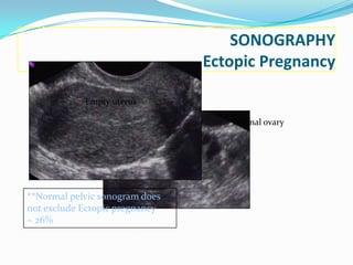 SONOGRAPHY
                                Ectopic Pregnancy

            Empty uterus

                                   Normal ovary




**Normal pelvic sonogram does
not exclude Ectopic pregnancy
~ 26%
 