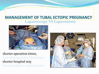 MANAGEMENT OF TUBAL ECTOPIC PREGNANCY
                Laparoscopy VS Laparotomy




shorter operation times,
less intraoperative blood loss,
shorter hospital stay
lower analgesic requirements
 