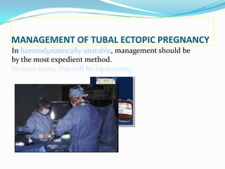 MANAGEMENT OF TUBAL ECTOPIC PREGNANCY
In haemodynamically unstable, management should be
by the most expedient method.
In most cases, this will be laparotomy.
 