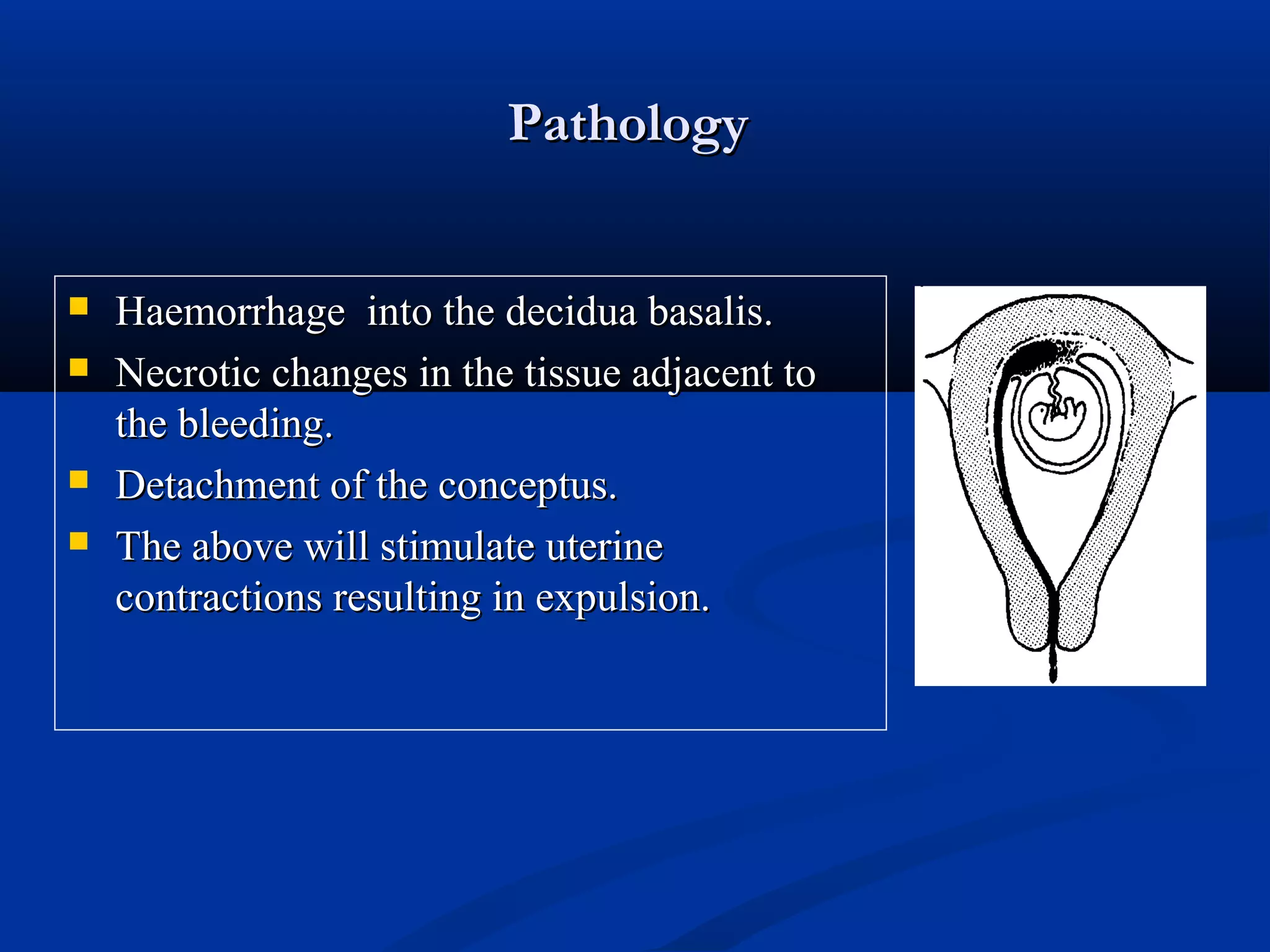 Pathology






Haemorrhage into the decidua basalis.
Necrotic changes in the tissue adjacent to
the bleeding.
Detachment of the conceptus.
The above will stimulate uterine
contractions resulting in expulsion.

 