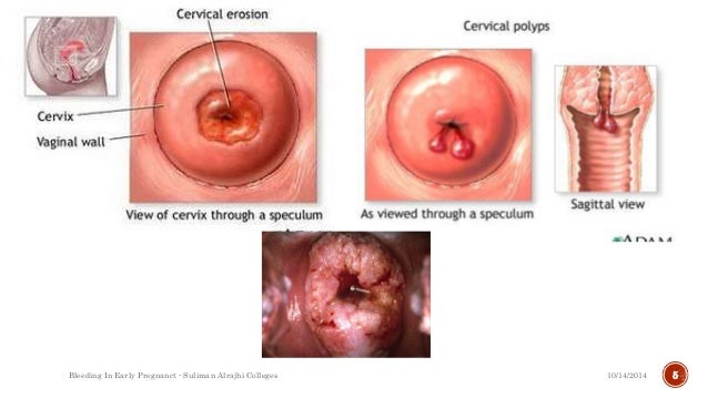 What does cervical mucus look like in pregnancy?