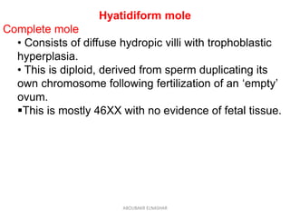 Hyatidiform mole
Complete mole
• Consists of diffuse hydropic villi with trophoblastic
hyperplasia.
• This is diploid, derived from sperm duplicating its
own chromosome following fertilization of an ‘empty’
ovum.
This is mostly 46XX with no evidence of fetal tissue.
ABOUBAKR ELNASHAR
 