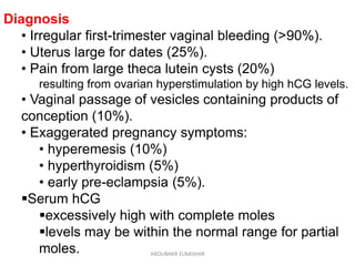 Diagnosis
• Irregular first-trimester vaginal bleeding (>90%).
• Uterus large for dates (25%).
• Pain from large theca lutein cysts (20%)
resulting from ovarian hyperstimulation by high hCG levels.
• Vaginal passage of vesicles containing products of
conception (10%).
• Exaggerated pregnancy symptoms:
• hyperemesis (10%)
• hyperthyroidism (5%)
• early pre-eclampsia (5%).
Serum hCG
excessively high with complete moles
levels may be within the normal range for partial
moles. ABOUBAKR ELNASHAR
 