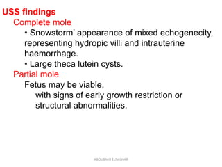 USS findings
Complete mole
• Snowstorm’ appearance of mixed echogenecity,
representing hydropic villi and intrauterine
haemorrhage.
• Large theca lutein cysts.
Partial mole
Fetus may be viable,
with signs of early growth restriction or
structural abnormalities.
ABOUBAKR ELNASHAR
 