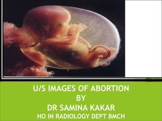 U/S IMAGES OF ABORTION
BY
DR SAMINA KAKAR
HO IN RADIOLOGY DEPT BMCH
 