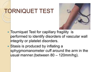 TORNIQUET TEST
 Tourniquet Test for capillary fragility is
performed to identify disorders of vascular wall
integrity or platelet disorders.
 Stasis is produced by inflating a
sphygmomanometer cuff around the arm in the
usual manner.(between 80 – 120mm/hg).
 