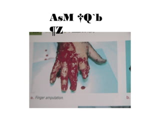 AsM †Q`b
¶Z
 