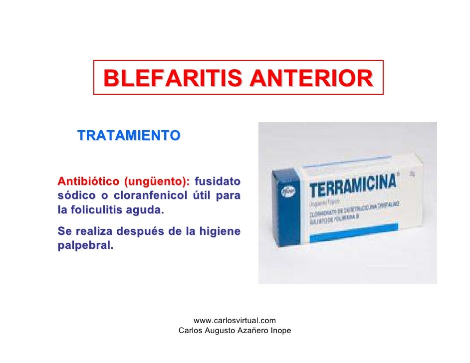 Blepharitis escamosa tratamiento pdf files