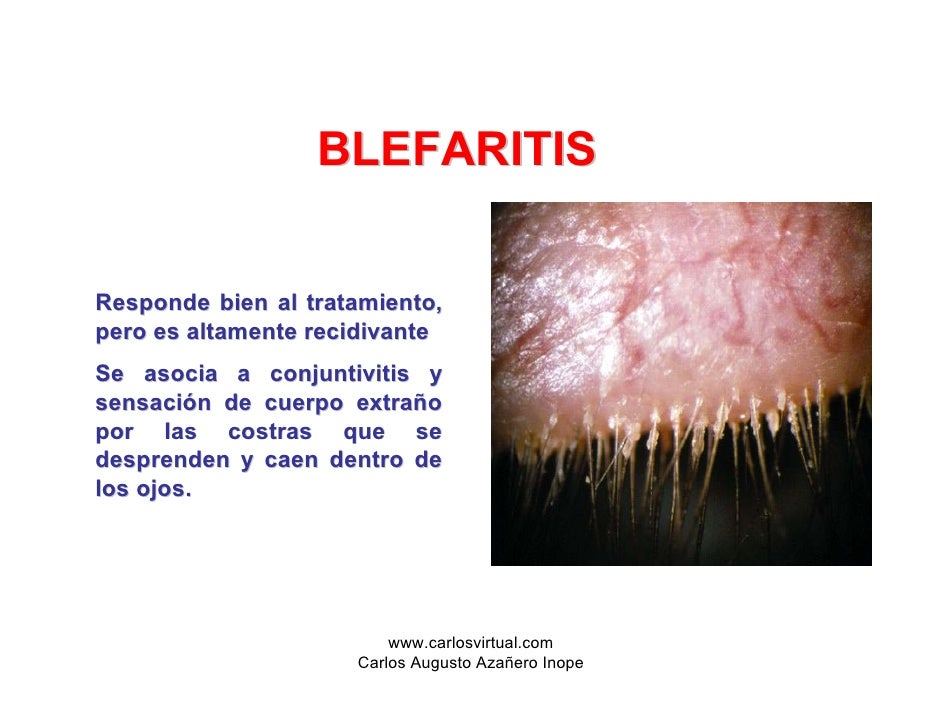 El polen para el tratamiento de la psoriasis