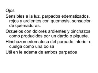 Ojos Sensibles a la luz, parpados edematizados, rojos y ardientes con quemosis, sensacion de quemaduras. Orzuelos con dolores ardientes y pinchazos como producidos por un dardo o piquete. Hinchazon edematosa del parpado inferior q cuelga como una bolsa  Util en le edema de ambos parpados  