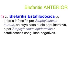 Blefaritis ANTERIOR 1)  La  Blefaritis Estafilocócica   se debe a infección por  Staphylococus aureus , en cuyo caso suele ser ulcerativa, o por  Staphylococus epidermidis  o estafilococos coagulasa negativos. 