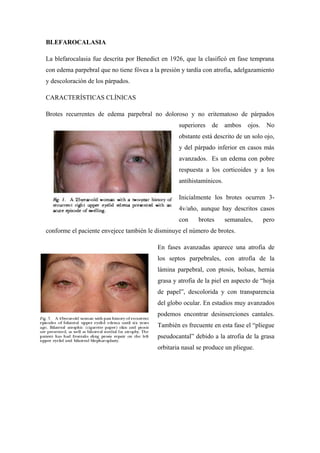 BLEFAROCALASIA
La blefarocalasia fue descrita por Benedict en 1926, que la clasificó en fase temprana
con edema parpebral que no tiene fóvea a la presión y tardía con atrofia, adelgazamiento
y descoloración de los párpados.
CARACTERÍSTICAS CLÍNICAS
Brotes recurrentes de edema parpebral no doloroso y no eritematoso de párpados
superiores

de

ambos

ojos. No

obstante está descrito de un solo ojo,
y del párpado inferior en casos más
avanzados. Es un edema con pobre
respuesta a los corticoides y a los
antihistamínicos.
Inicialmente los brotes ocurren 34v/año, aunque hay descritos casos
con

brotes

semanales,

pero

conforme el paciente envejece también le disminuye el número de brotes.
En fases avanzadas aparece una atrofia de
los septos parpebrales, con atrofia de la
lámina parpebral, con ptosis, bolsas, hernia
grasa y atrofia de la piel en aspecto de “hoja
de papel”, descolorida y con transparencia
del globo ocular. En estadios muy avanzados
podemos encontrar desinserciones cantales.
También es frecuente en esta fase el “pliegue
pseudocantal” debido a la atrofia de la grasa
orbitaria nasal se produce un pliegue.

 