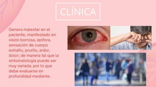 CLÍNICA
Genera malestar en el
paciente, manifestado en
visión borrosa, epifora,
sensación de cuerpo
extraño, prurito, ardor,
dolor; de manera tal que la
sintomatología puede ser
muy variada; por lo que
debe evaluarse en
profundidad mediante.
 