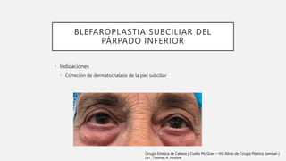 BLEFAROPLASTIA SUBCILIAR DEL
PÁRPADO INFERIOR
• Indicaciones
• Correción de dermatochalasis de la piel subciliar
Cirugia Estetica de Cabeza y Cuello Mc Graw – Hill Altras de Cirugía Plástica Samiuel J.
Lin . Thomas A. Mustoe
 