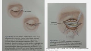 Cirugia Estetica de Cabeza y Cuello Mc Graw – Hill Altras de Cirugía Plástica Samiuel J.
Lin . Thomas A. Mustoe
 