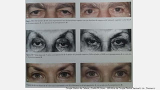 Cirugia Estetica de Cabeza y Cuello Mc Graw – Hill Altras de Cirugía Plástica Samiuel J. Lin . Thomas A.
 